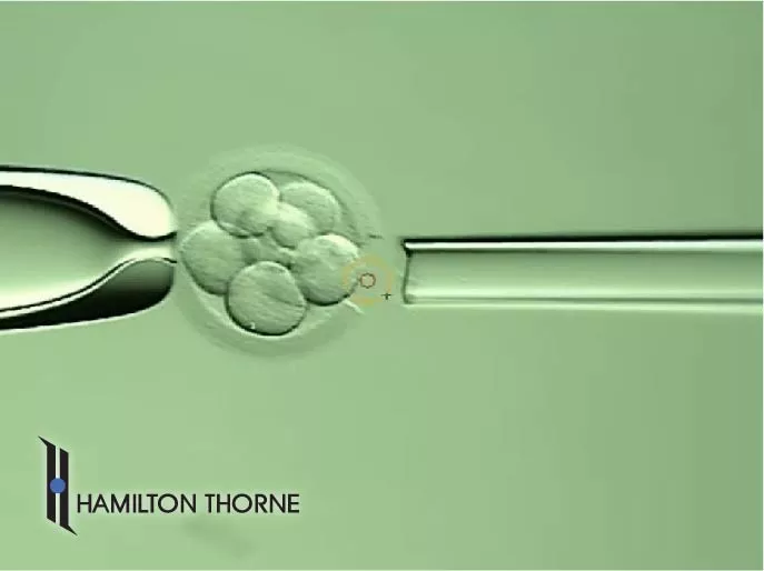 Hamilton Thorne ZILOS-tk Clinical laser